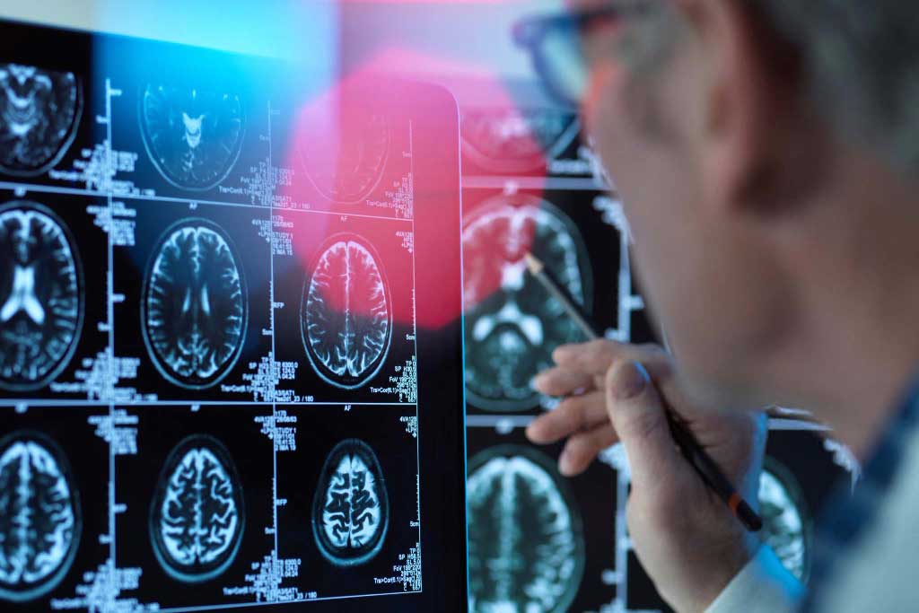 Neurólogo Centro de Especialidades Médicas Cumbres del Santuario