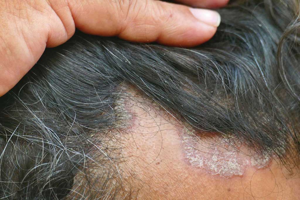 Médico dermatólogo Centro de Especialidades Médicas Cumbres del Santuario