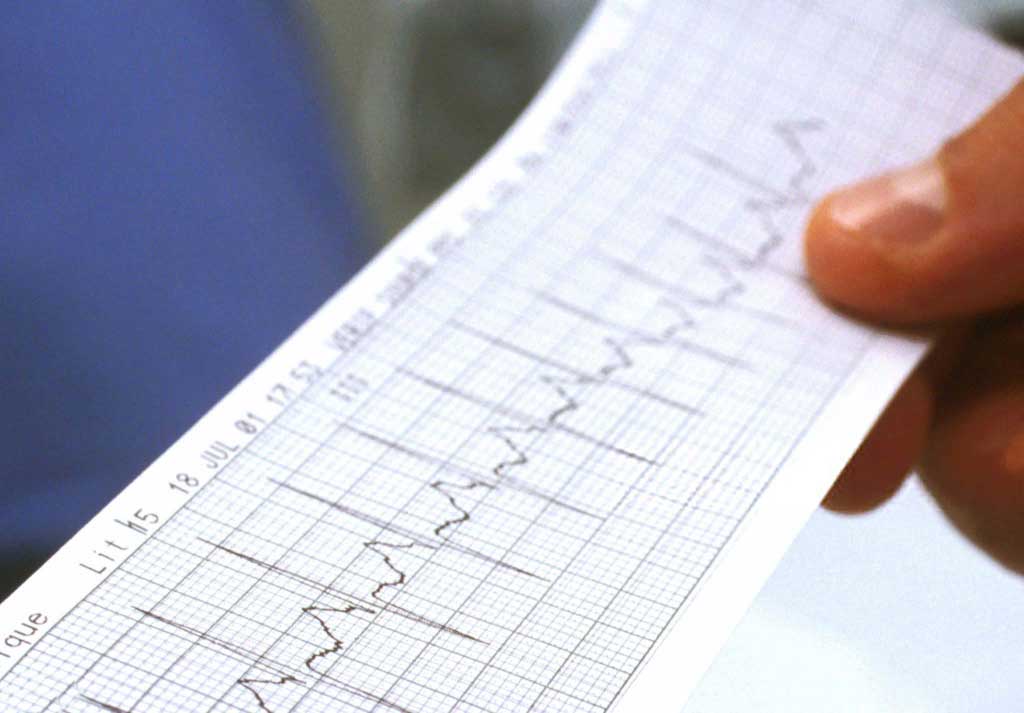 Médico cardiólogo Centro de Especialidades Médicas Cumbres del Santuario