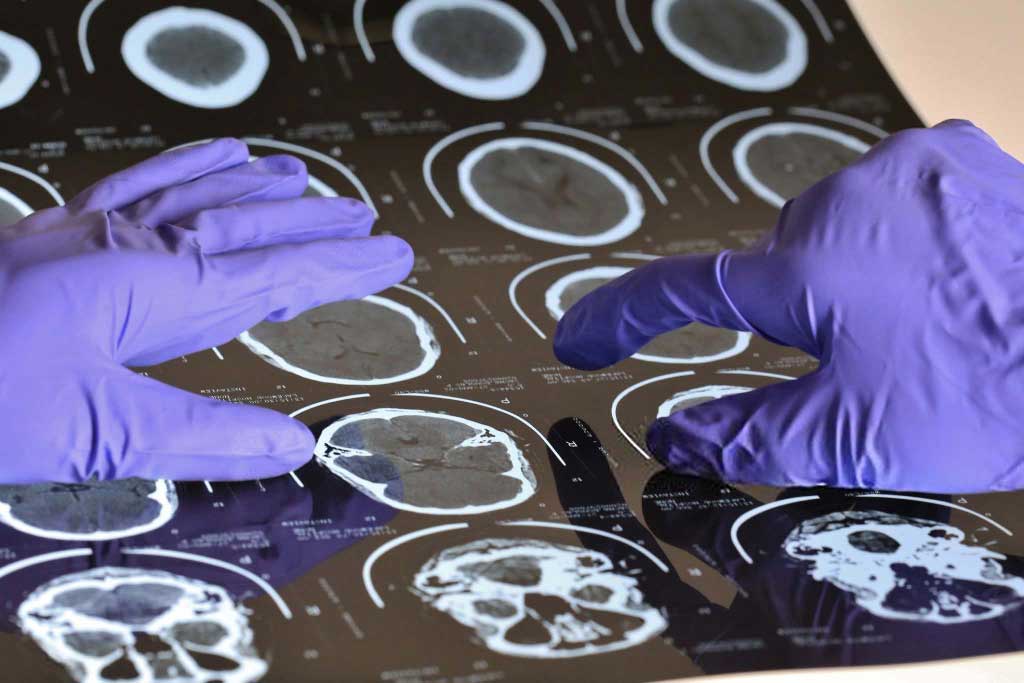 Neurocirugía Centro de Especialidades Médicas Cumbres del Santuario
