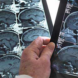 Medico Neurocirugía Adultos